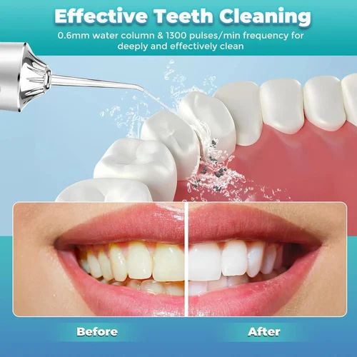 WATER DENTAL FLOSSER
